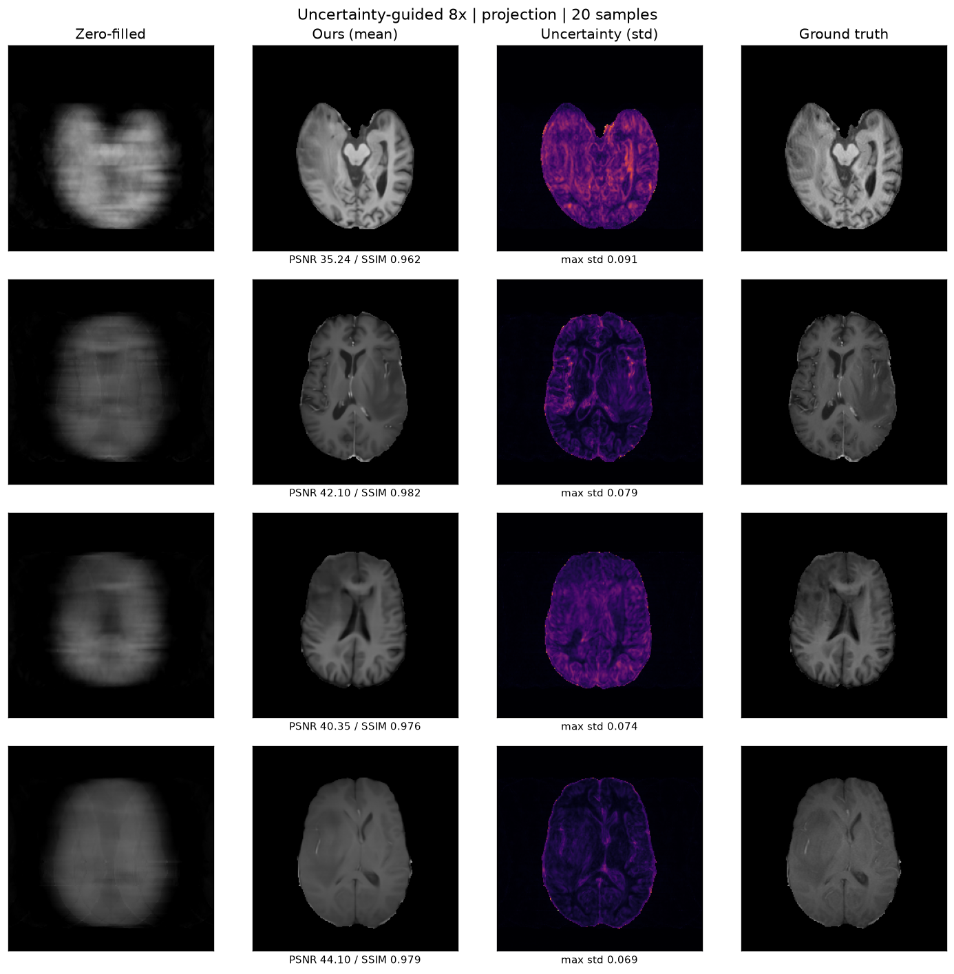 Four-column 8× result: the zero-filled input, the MMSE mean reconstruction, a per-pixel uncertainty heatmap that is brightest where the reconstruction is least certain, and the ground-truth scan. The uncertainty column is the output the original method does not produce.